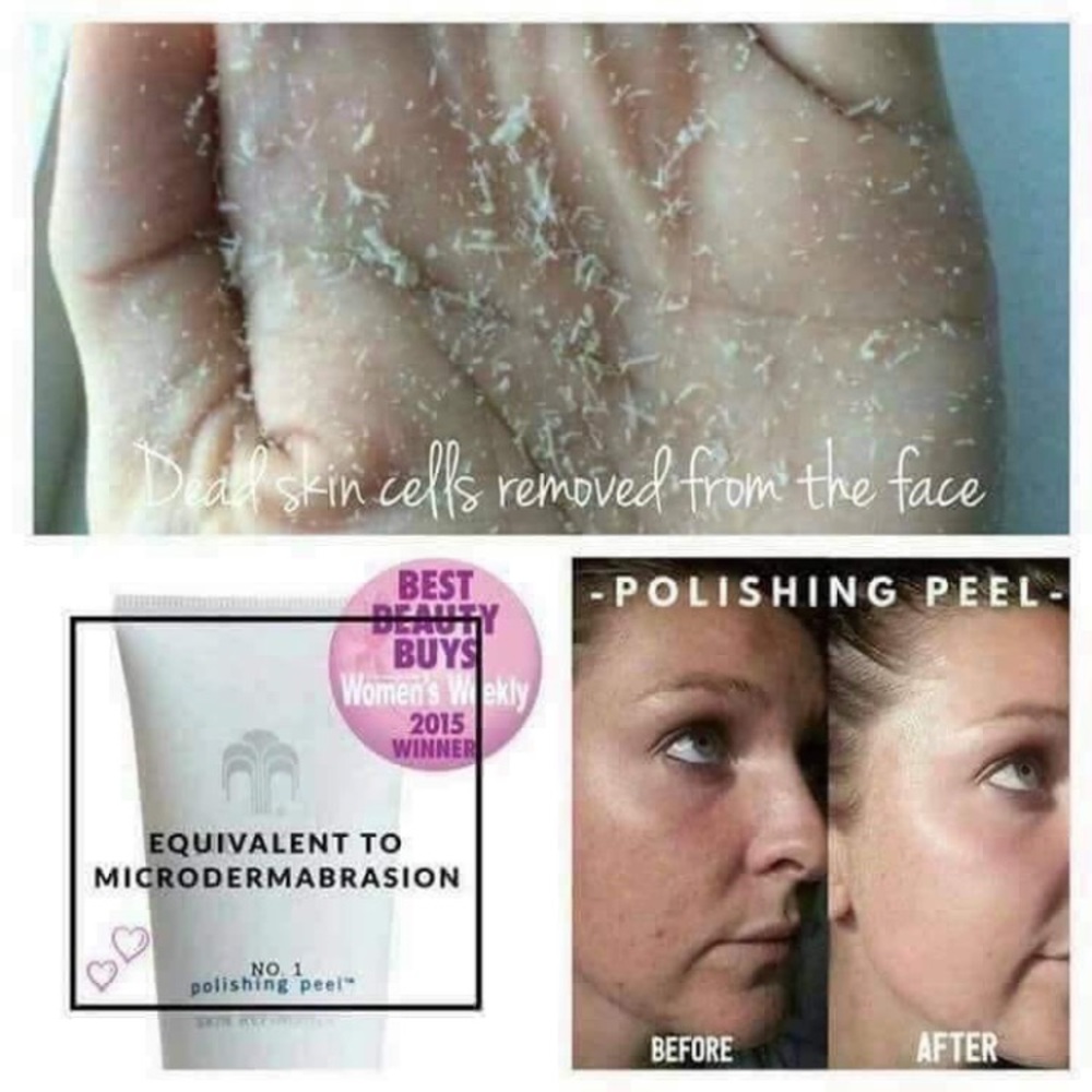 Dead skin remover